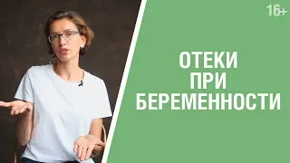 Как лечить отеки при беременности? Причины возникновения и способы профилактики. Йогатерапия  16+