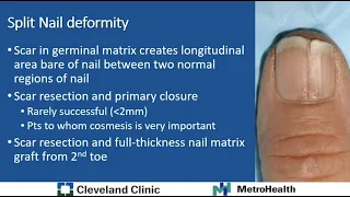 Nail & Nail Bed Conditions - Dayton Opel, MD