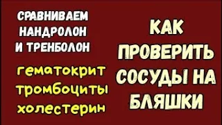 ТРЕНБОЛОН и НАНДРОЛОН сравнение. Проверяем сосуды на бляшки. Анализы на курсе.Гептрал. Гематокрит.