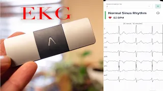 EKG at Home - KardiaMobile 6-Lead Personal EKG Monitor
