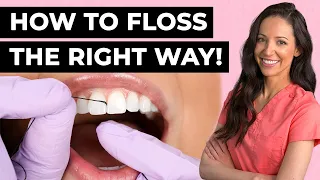 How To Properly Floss Your Teeth (Dental Hygienist Explains)