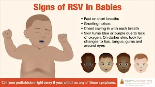 Signs & Symptoms of RSV in Babies | AAP