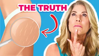 The TRUTH About Cellulite Every Woman NEEDS to Know...