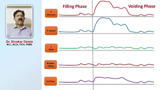 Urodynamic study of voiding phase of bladder