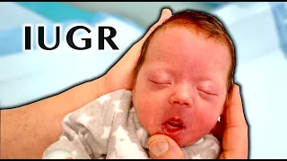 RARE INTRAUTERINE GROWTH RESTRICTION (IUGR) | Dr  Paul