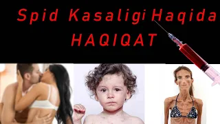 Spid Kasaligi Haqida "HAQIQAT" | Спид Касалиги Хакида Хакикат