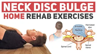 Neck Disc Bulge/Herniation Rehab Exercises