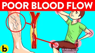 5 Causes of Poor Blood Circulation