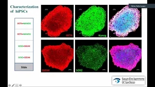 Genetic Architecture and Underlying Molecular Pathology by Radha Ayyagari, PhD | UCI CTVR