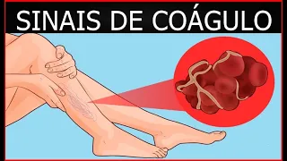 10 Sinais De Coágulo No Sangue Que Você Não Deve Ignorar