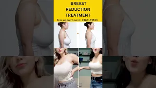 Breast Reduction Treatment #hospital #health #clinic #shorts #healtyfood #viral #telugushorts