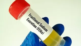 Using Fractional Excretion of Sodium Test to determine Tubular Reabsorption