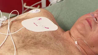 Synchronized Cardioversion with the HeartStart Intrepid monitor/defibrillator
