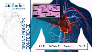 Cardiovascular Considerations in COVID-19 Infections (Mouaz Al-Mallah, MD) April 9, 2020