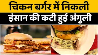 Horrified woman finds HUMAN FINGER inside burger| बर्गर में इंसान की अंगुली| Sunnice News