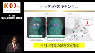 第12回市民公開講座　基調講演　パーキンソン病ってどんな病気？