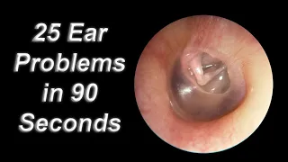 25 Ear Problems in 90 Seconds