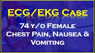 ECG/EKG Case Review: 74 y/o female that had been having chest pain, nausea, and vomiting.