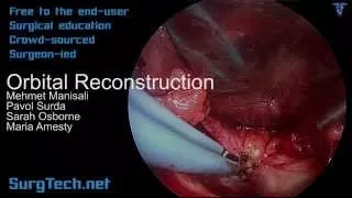 SurgTech Orbital Reconstruction