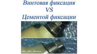 Винтовая фиксация vs цементной фиксации коронки на имплантате. Особенности выбора абатмента.