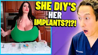 Plastic Surgeon Reacts to LARGEST Implants in US! EXTREME Bodies Explained!