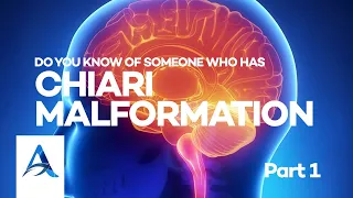 Do you know of someone who has Chiari Malformation?