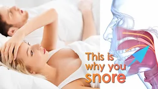 Why you can't stop snoring?