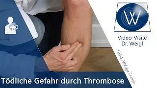 Die tödliche Gefahr durch Thrombose - Ursachen, Symptome & Tipps bei tiefer Beinvenenthrombose (TVT)