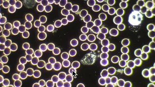Ausschnitt einer Dunkelfeld-Blutdiagnostik V