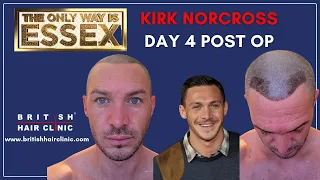 ‘ I did this for me, not anyone else.  To make myself feel a little more confident’ - Kirk Norcross