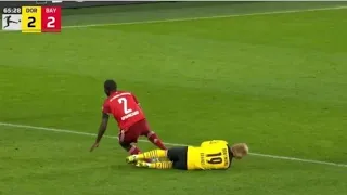 Brandt head INJURY Vs Bayern Munich