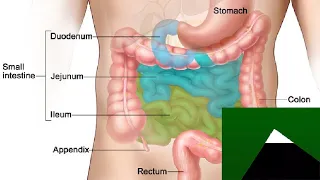 Fixing Your Hiccups Starts at the Duodenum, I'm a Doctor