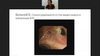 Современные эндоскопические методы в комплексном лечении туберкулеза органов дыхания