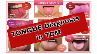 Tongue Diagnosis in Chinese Medicine