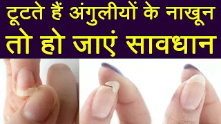 Reasons your Nails keep Breaking: नाखून अक्सर टूट जातें है, तो ये है बड़ी वजह | Boldsky