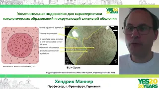 44. Эндоскопическое лечение раннего рака в пищеводе Баррета - необычный случай. Х. Маннер