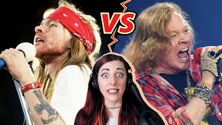 AXL ROSE: What happened to his voice? | Vocal Analysis