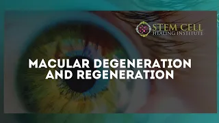 Stem Cell Therapy for Macular Degeneration and Regeneration