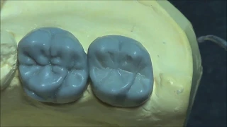 Live wax up - Upper 2nd molar(full)