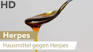 Herpes an der Lippe? Dieses natürliche Hausmittel kann helfen!