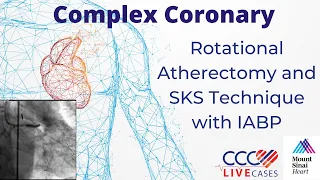 Rotational Atherectomy and SKS Technique with IABP - September 15, 2009 Webcast Video