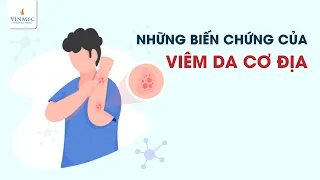 Viêm da cơ địa và những biến chứng không thể coi thường