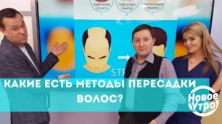 Какие есть методы пересадки волос?