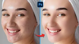 How to smooth skin in Photoshop 2023 || How do I make my face smoother in Photoshop?