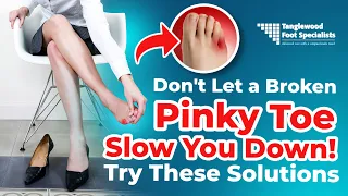 Don't Let a Broken Pinky Toe Slow You Down! Try These Solutions