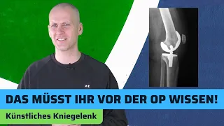 Wie lange hält ein künstliches Kniegelenk (Knie TEP)?