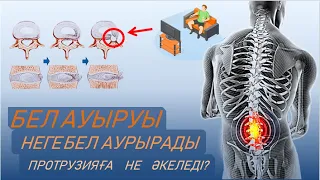 ПРОТРУЗИЯ,БЕЛ АУЫРУЫ I Себептері,Симптомдары I ПРОТРУЗИЯНЫҢ  белгілері