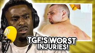 TGFbro Reveal Their WORST Injuries!