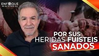 POR SUS HERIDAS FUISTEIS SANADOS:   SANIDAD - MILAGROS Y LIBERACION. ISAIAS 53: 4-5