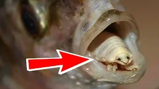 10 Creepiest Parasites In The World